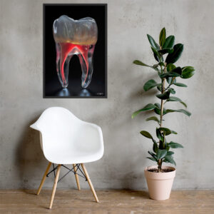Endodontic art II (Limited Copies)