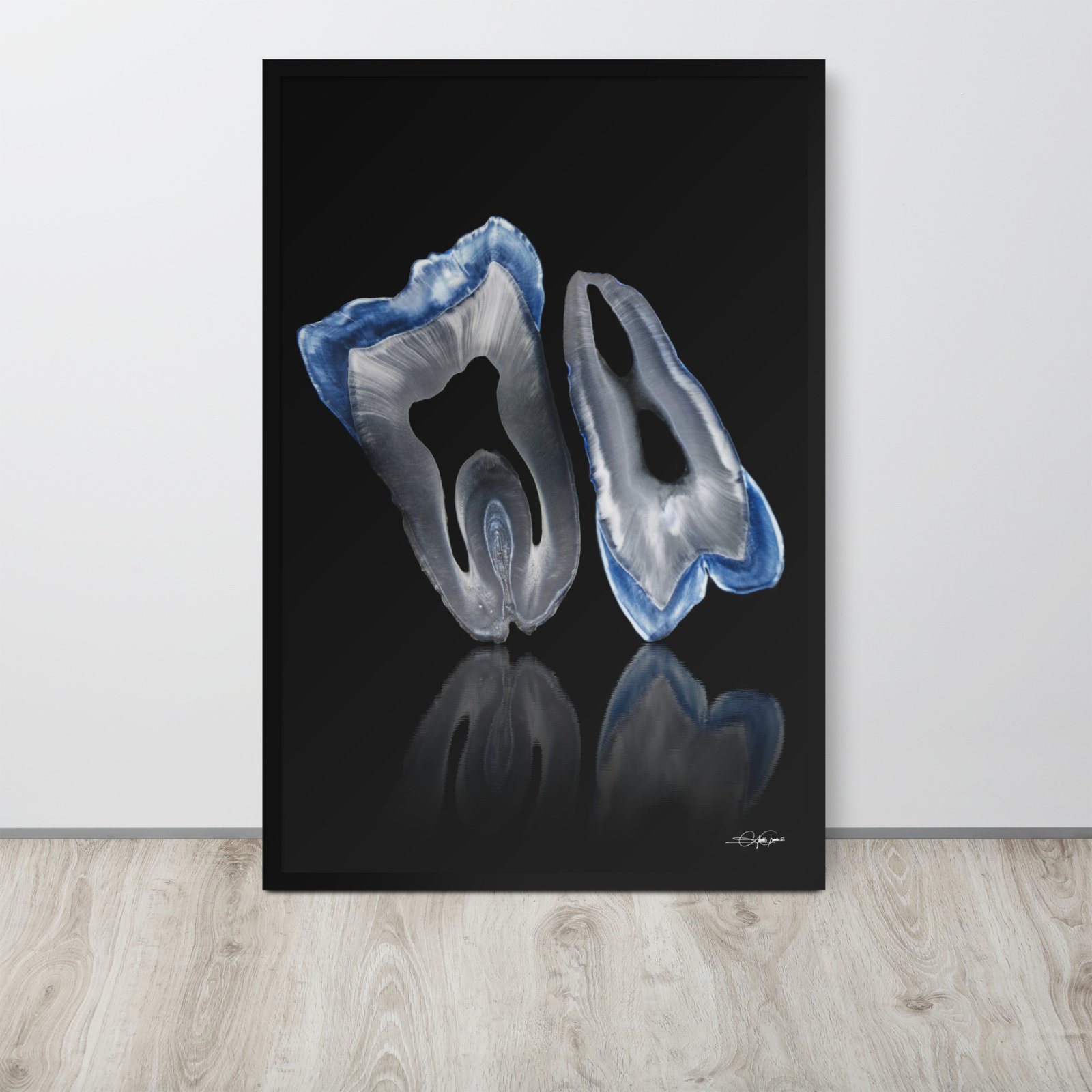 Molar and premolar Blue (Framed)