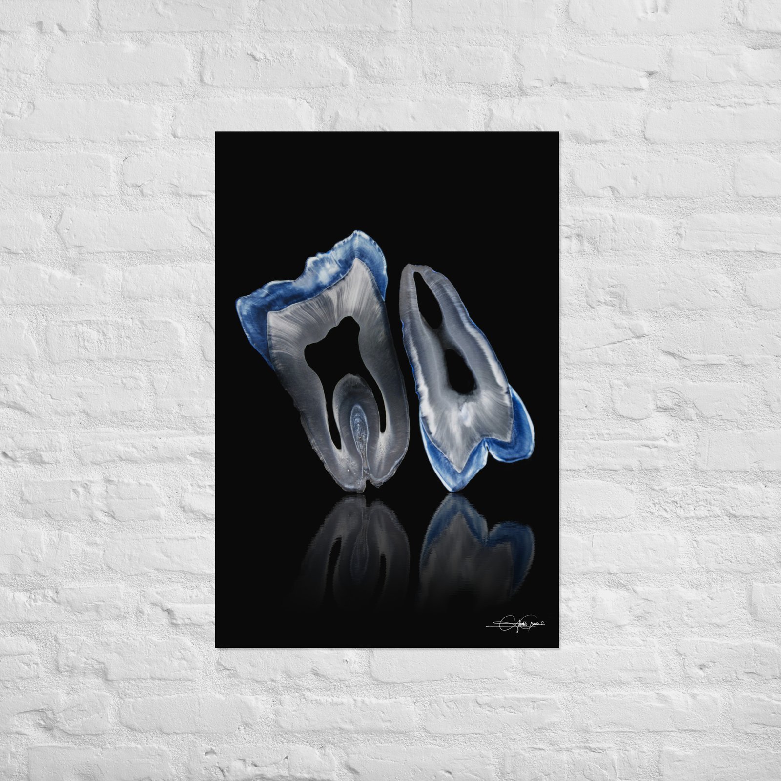 Molar and premolar Blue (Print)