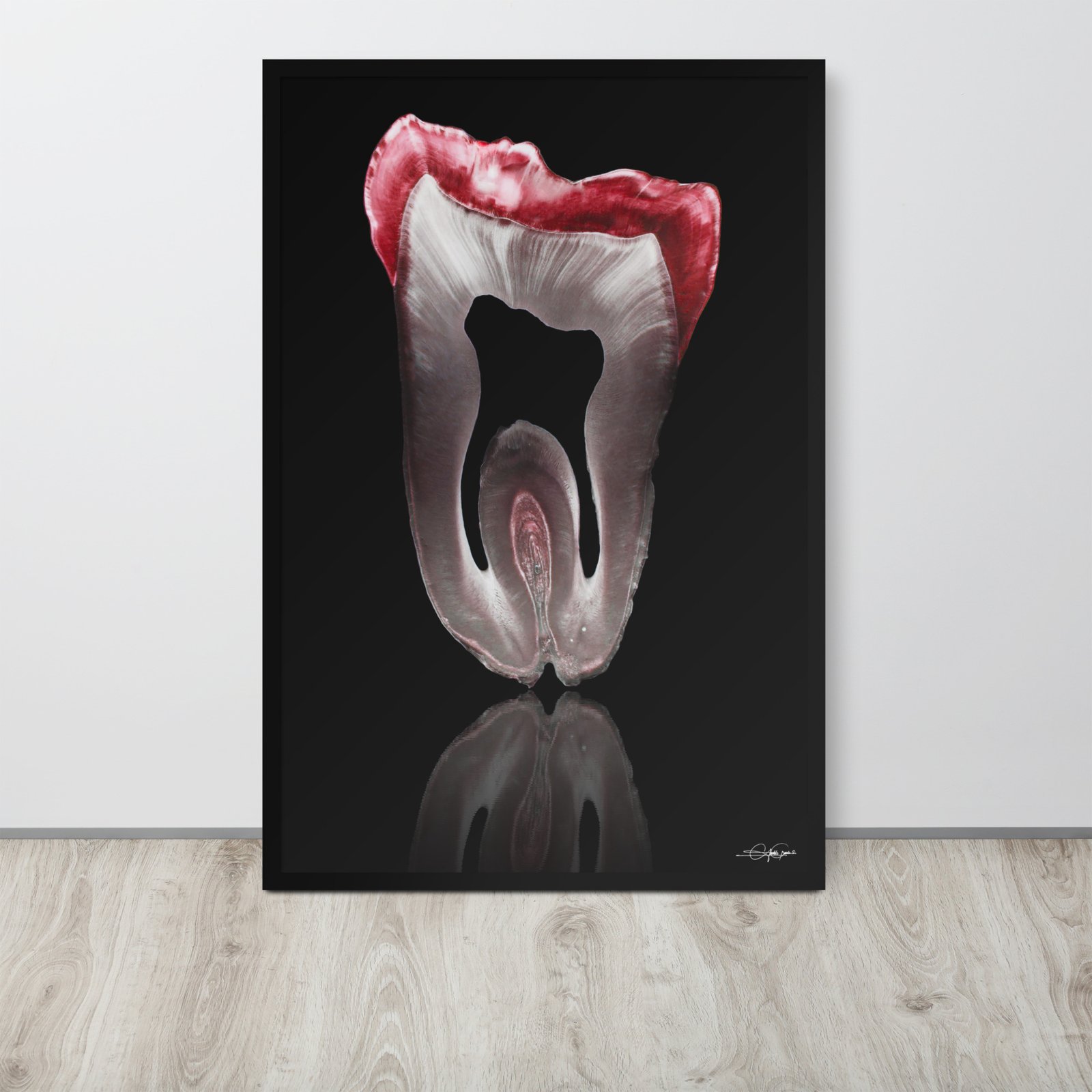 Molar Carmesí (Framed limited copies)