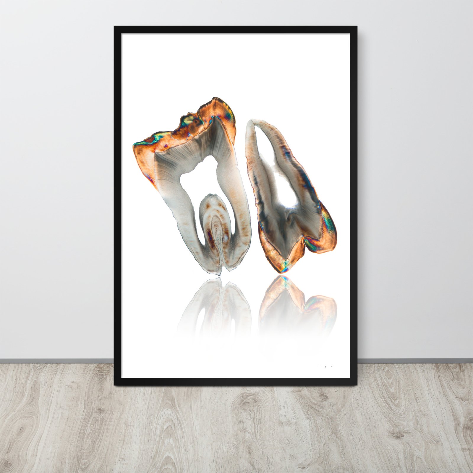 Golden II Molar and premolar (Framed limited copies)