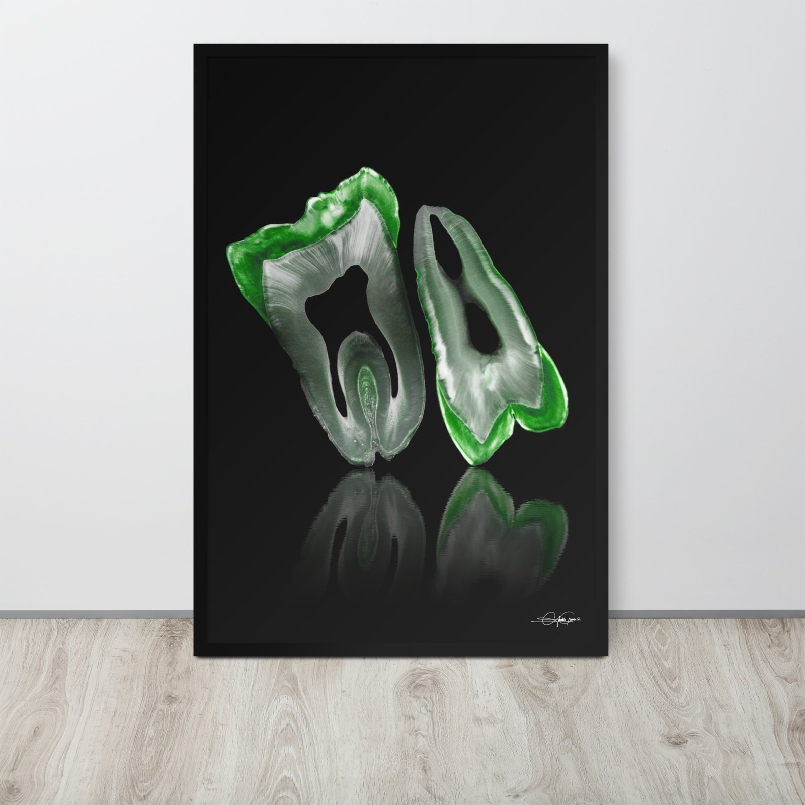 Green Molar and Premolar (Framed limited copies)