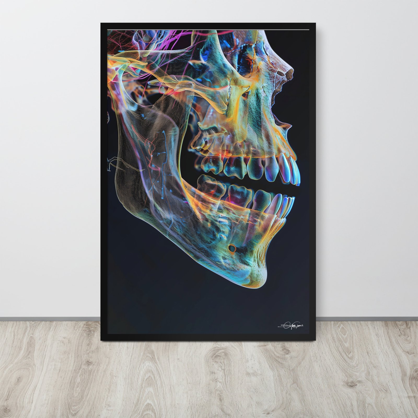 Maxilart II