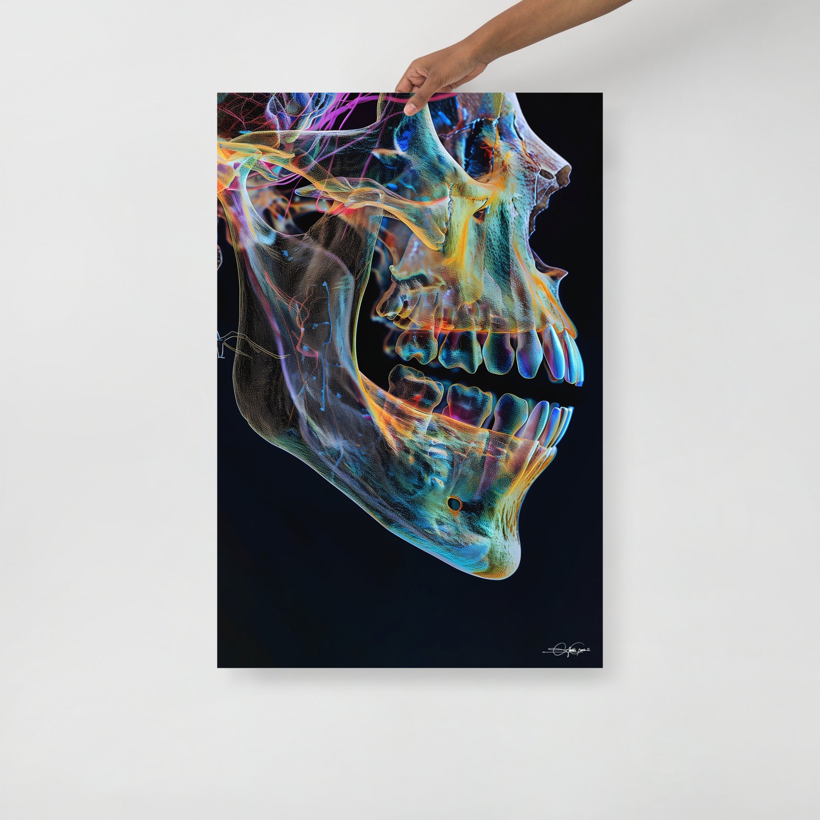 Maxilart II