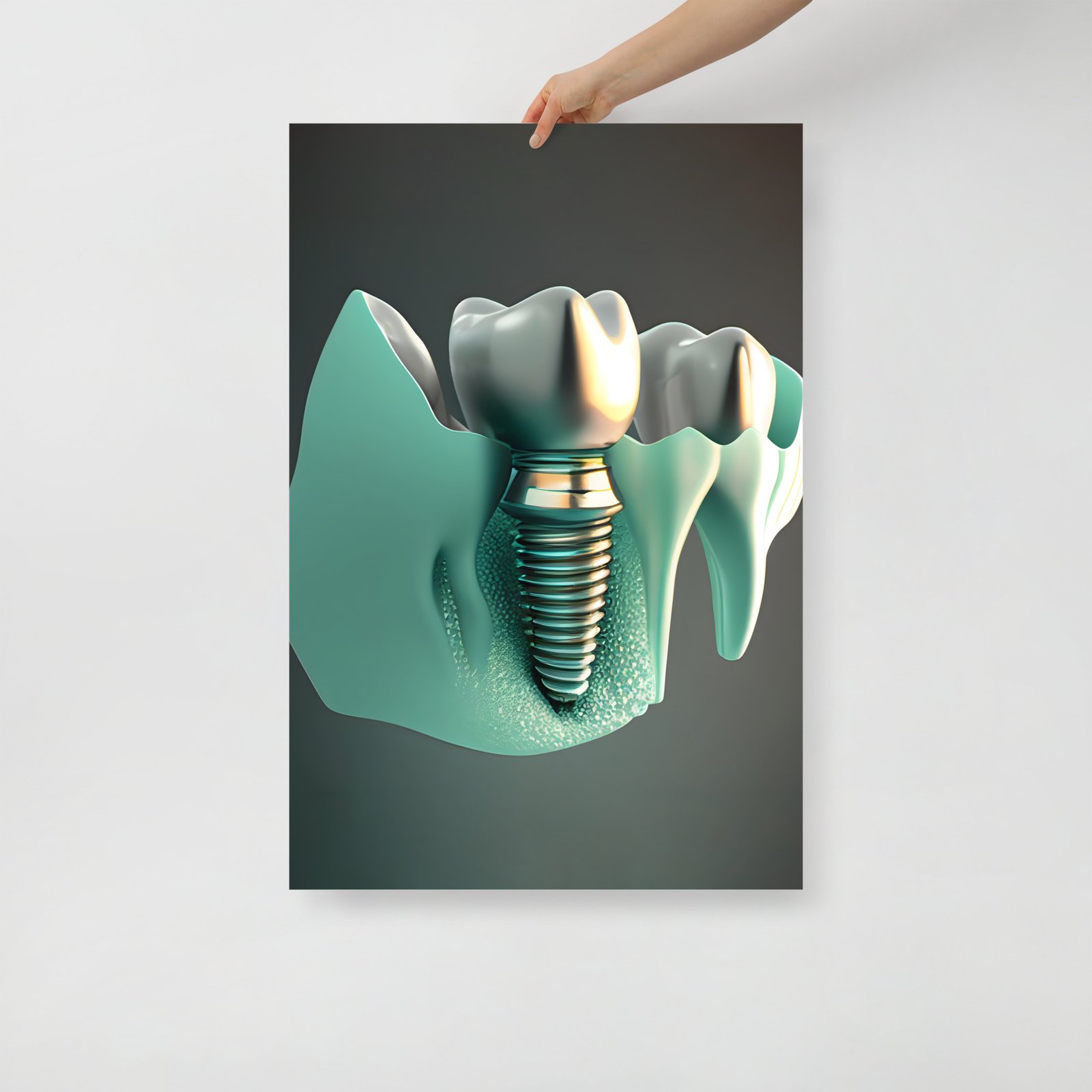 Dental implant III