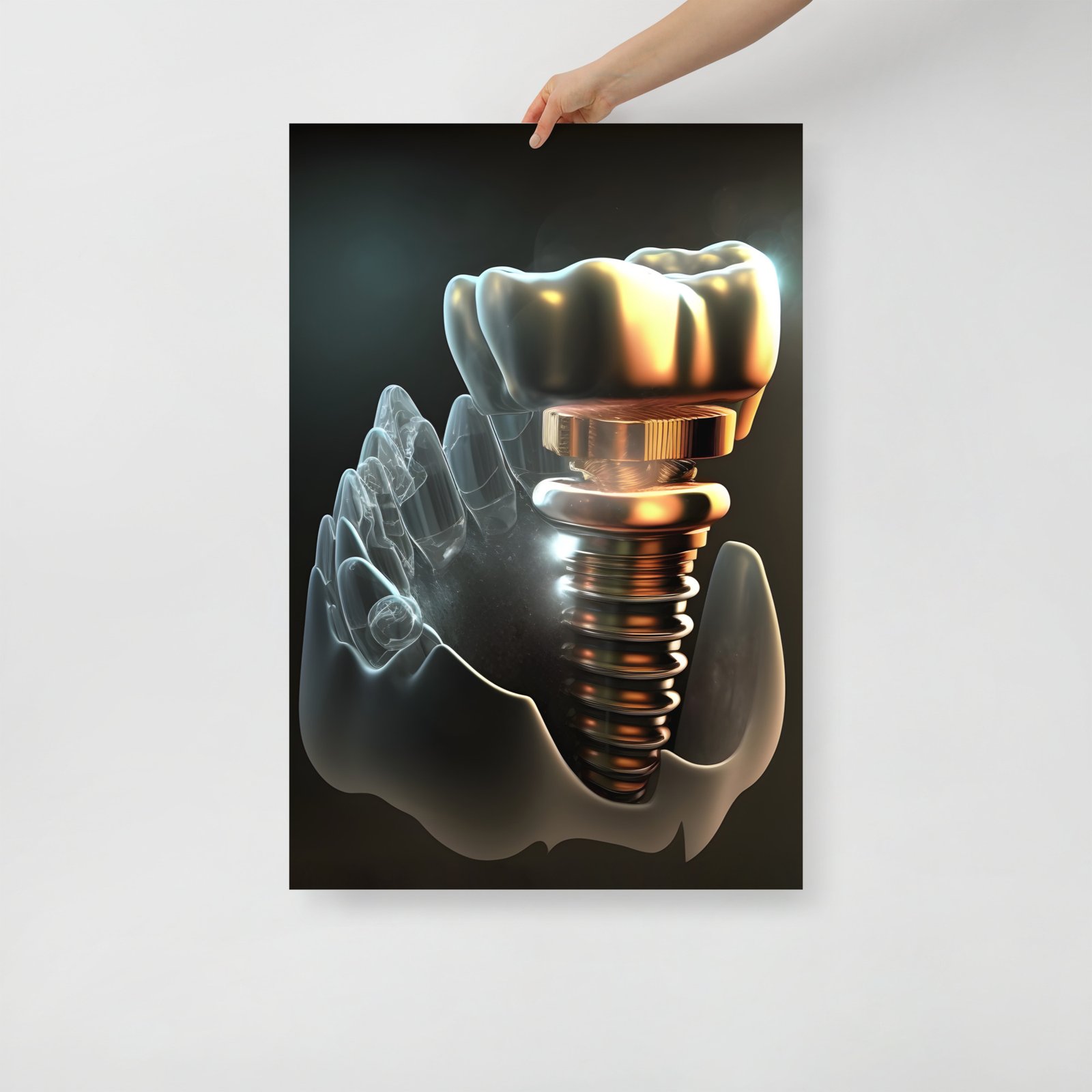Dental implant IV
